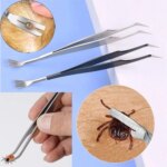2-in-1 Stainless Steel Pet Dog Louse Flea Tweezers Safe Cat Dog Lice Flea Remover Cleaning Tool Tick Tweezers Durable Easy Use - Image 3
